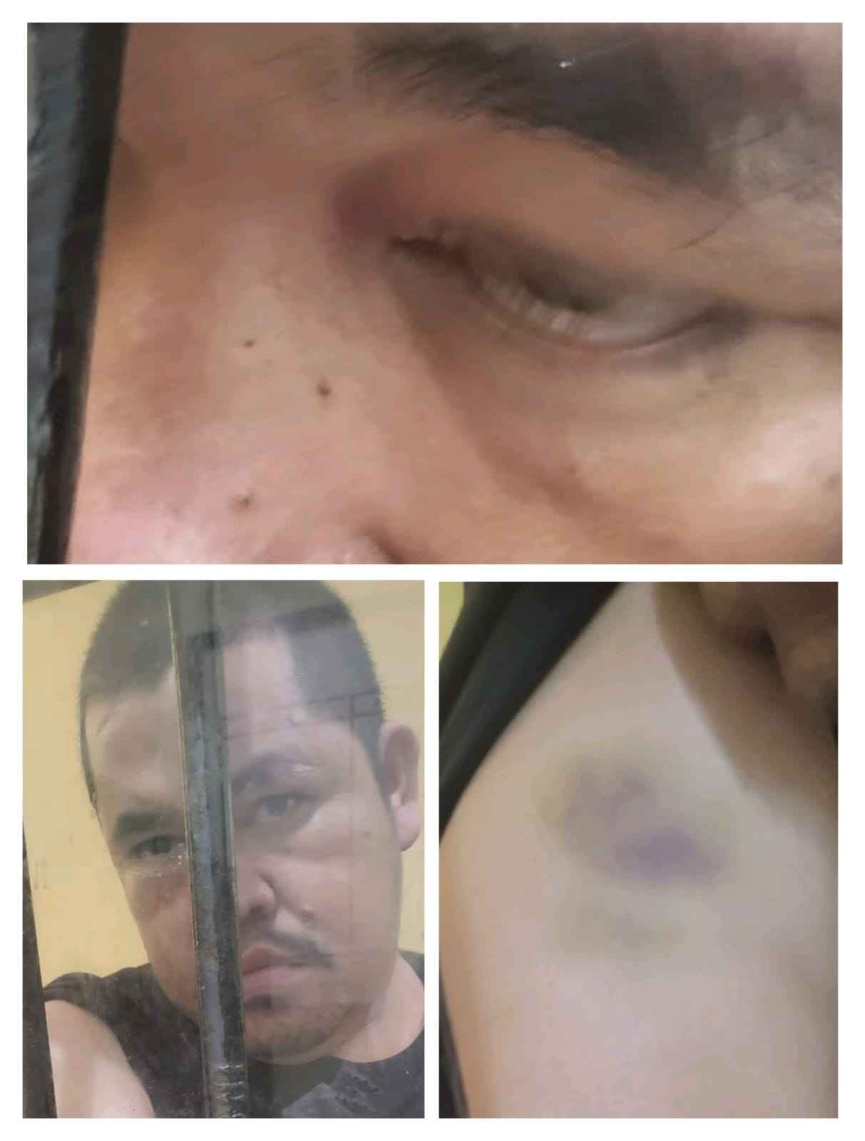 TAHANAN DI POLRES PELALAWAN ALAMI PENGANIAYAAN. KNPI RIAU MINTA KAPOLDA RIAU COPOT KAPOLRES PELALAWAN