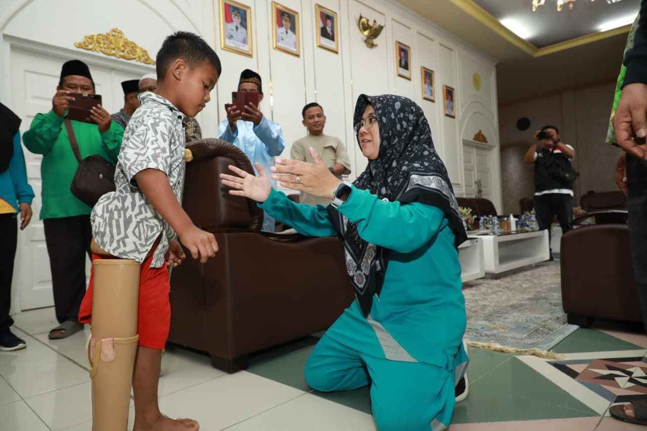 Afni Tepati Janji: Yuda Anak Disabilitas itu, Kini Punya Kaki Palsu.